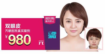鞍山齊敏 980元雙眼皮手術(shù)，開(kāi)啟美麗雙眸新篇章